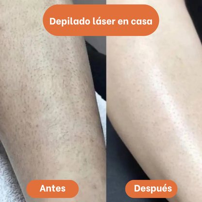 Depiladora YES® - Sin dolor ni irritación